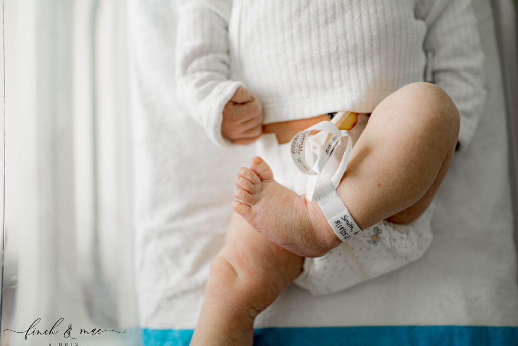 Close-up of newborn baby’s tiny legs, hospital bracelet, and umbilical cord during Fresh 48 hospital photography in Madison, Wisconsin.